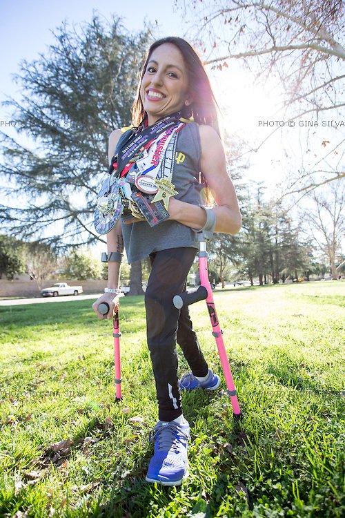 NiaKarmann's tweet photo. Please consider representing the #SpinaBifida community with @TatyanaMcFadden and @LilMistyDiaz. Do some research and you will find all kinds of role models from our community of individuals. Not just Spina Bifida individuals Women and Men. #itsourturnnow #differentisbeautiful https://t.co/Zak1XvOrud