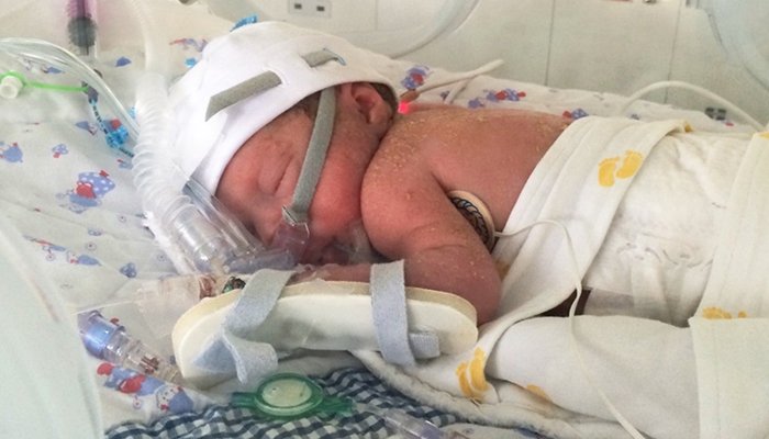 After discovering she was pregnant with identical #twins, Sarah’s #pregnancy journey became a fight for the lives of her twin boys. It was at her 20 week scan at her local hospital, that alarm bells first started ringing. Read Sarah's story here: tamba.org.uk/ttts/my-story
#TTTS