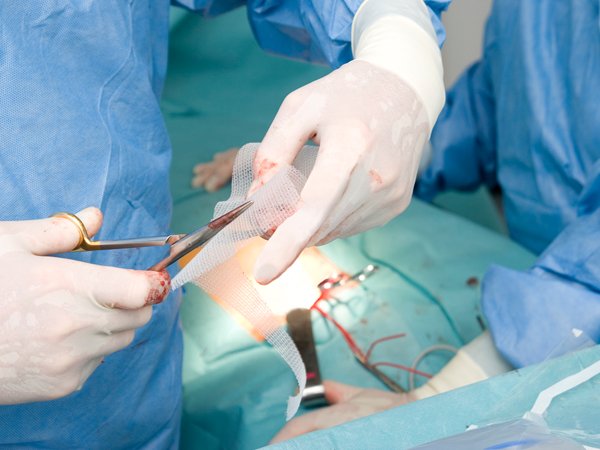 HerniaMeshHelp's tweet image. Complications from #HerniaMesh may include abnormal #liver function ==&amp;gt; ow.ly/3JQu309DGtM #hernia #mesh #lawsuit