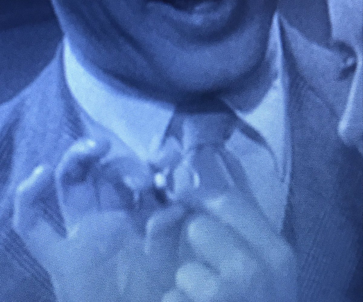 TiMEoFPoSTiNG's tweet photo. #ShadowOfADoubt has a significant emerald💍ring, which loosely echoes the crucial piece of evidence in #TheRobberBridegroom👈🏻
(I enjoyed the #FebruaryAngels,
but #GrimmMarch_en is a fun
theme as well!) https://t.co/okQ3P9i2Nn