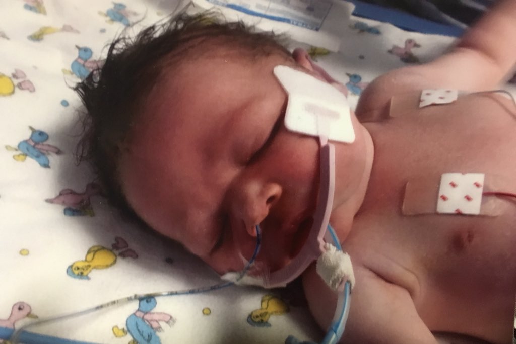 godfrey_esther's tweet photo. @Phil_Footprints Thanks for sharing! This is Juno and I am Juno’s proud mum.... and I can’t believe Andy is running such a long long way for @SandsUK on what should be my girls first birthday... it’s so amazing! 🙌 #JunoInspired #babyloss #46miles #islandrun https://t.co/j2yBh9Dxit