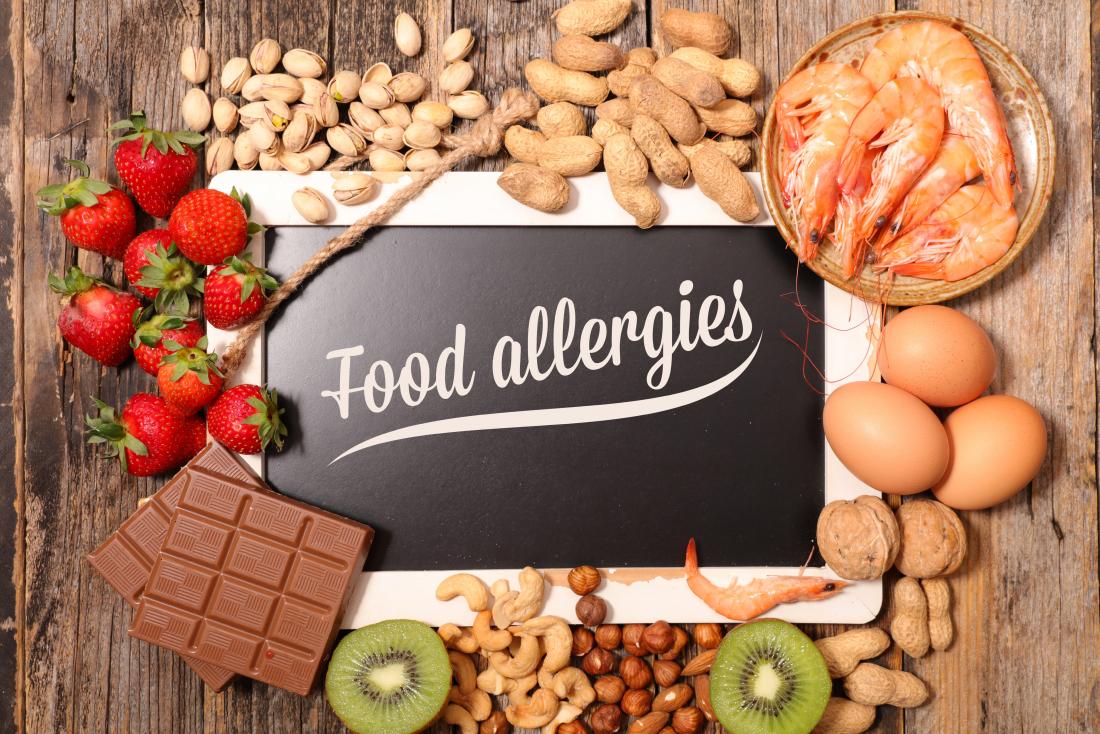 MNT_Hannah's tweet photo. How to cope with your food allergy https://t.co/woOV9vNT3S #foodallergy #foodallergies https://t.co/DYNvau12tl