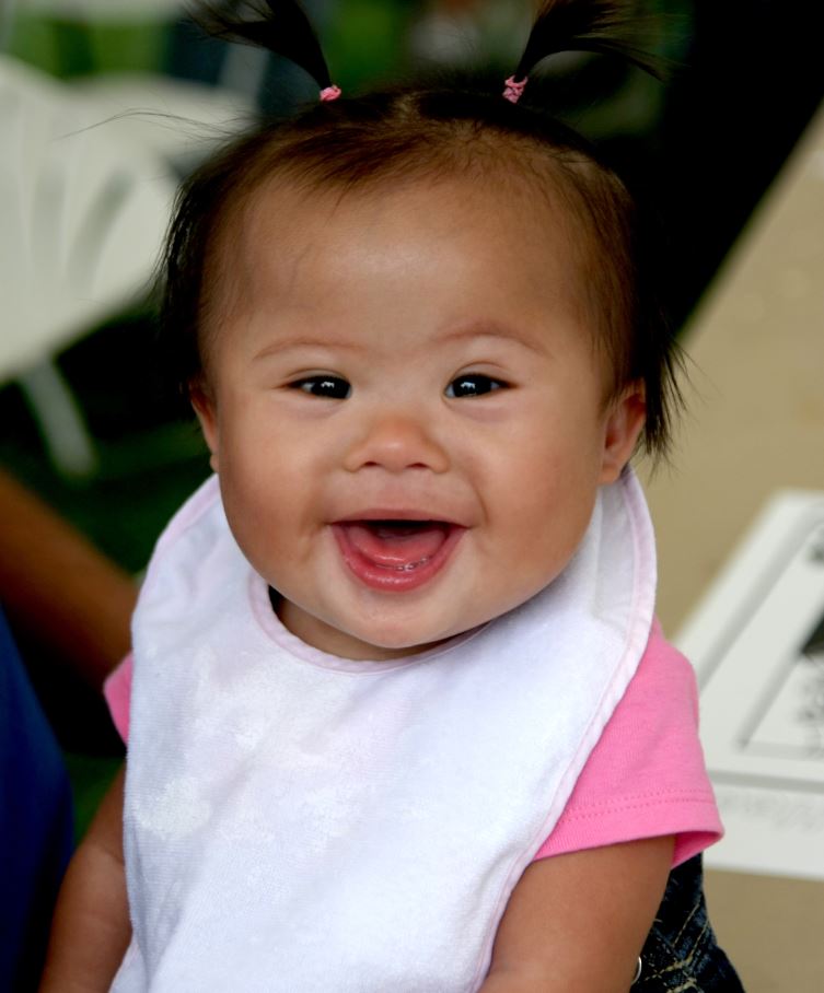GDSFoundation's tweet photo. Urgent Global Advocacy Alert ❗️📣We need your help in our advocacy efforts to increase NIH Funding for Down Syndrome Research! Please write your Representatives and/or Senators TODAY #FundDSResearch https://t.co/abcOxs7KoZ https://t.co/ll5D6bzAr6