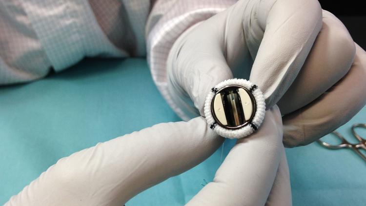 chicagotribune's tweet photo. FDA approves world's smallest mechanical heart valve, made by North Chicago company Abbott Laboratories, for use in infants and toddlers. https://t.co/umw780WDWh https://t.co/vzj7nlpRw2