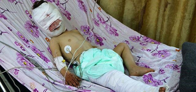 Justice4Kurds's tweet photo. #Turkroaches be like: “This is a fake picture from 20000000BC.. This little kid is as a PKK-terrorist.. turkiye very innocent..”.. All I have to say to all of you stinky kebab fuckers..We will never give up on what we are fighting for! #SaveAfrin har bji #YPG #PKK #YPJ #Peshmerga https://t.co/atPUKKlYAo