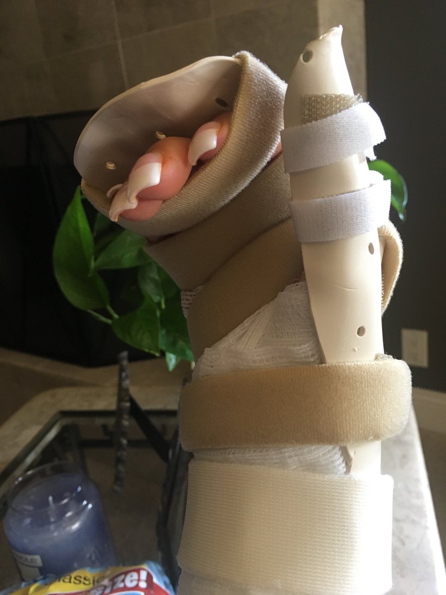 TinaFerguson's tweet photo. My new temporary cast and new meds, my fingers are looking forward to dancing. Thank you for all the thoughts and prayers💕 https://t.co/S4x6Ay3GqR
