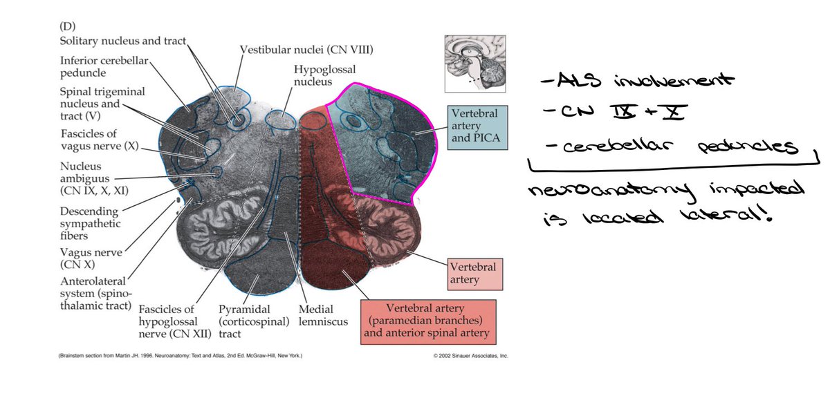 AJVolk28's tweet photo. You can use a brain stem map and your neuroanatomy knowledge to help you locate the vasculature affected in a stroke! #pt546week9 #everythingsokayonpjday @juliehershberg https://t.co/4WxtJr6YGD