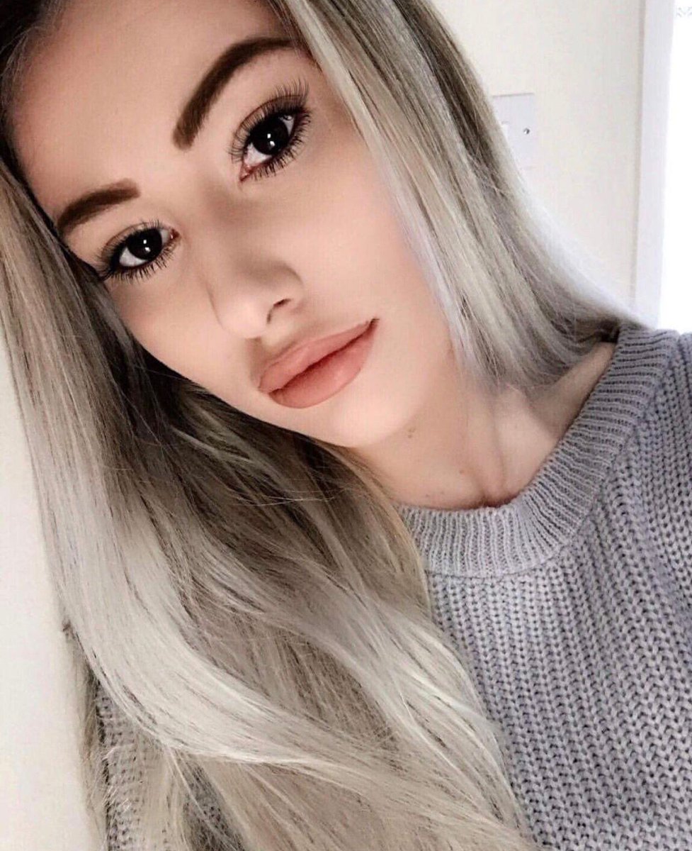 What an absolutely stunning result by 1 of our customers w/ 1ml of DERM only. DERM > ideal for fine lines (lipstick lines, dynamic cheek lines, superficial nasolabial and marionette lines) &amp; with adequate anaesthetic gel &amp; appropriate training, lip augmentation.
#aesthetics