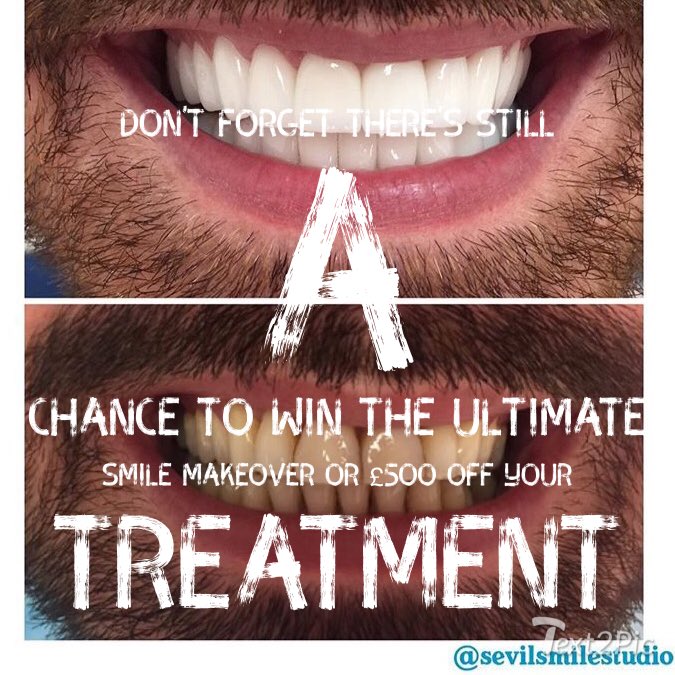 For Your Chance To Win This Unbelievable Prize Visit My Instagram Page Robert Anthony King It's So Sinply To Enter