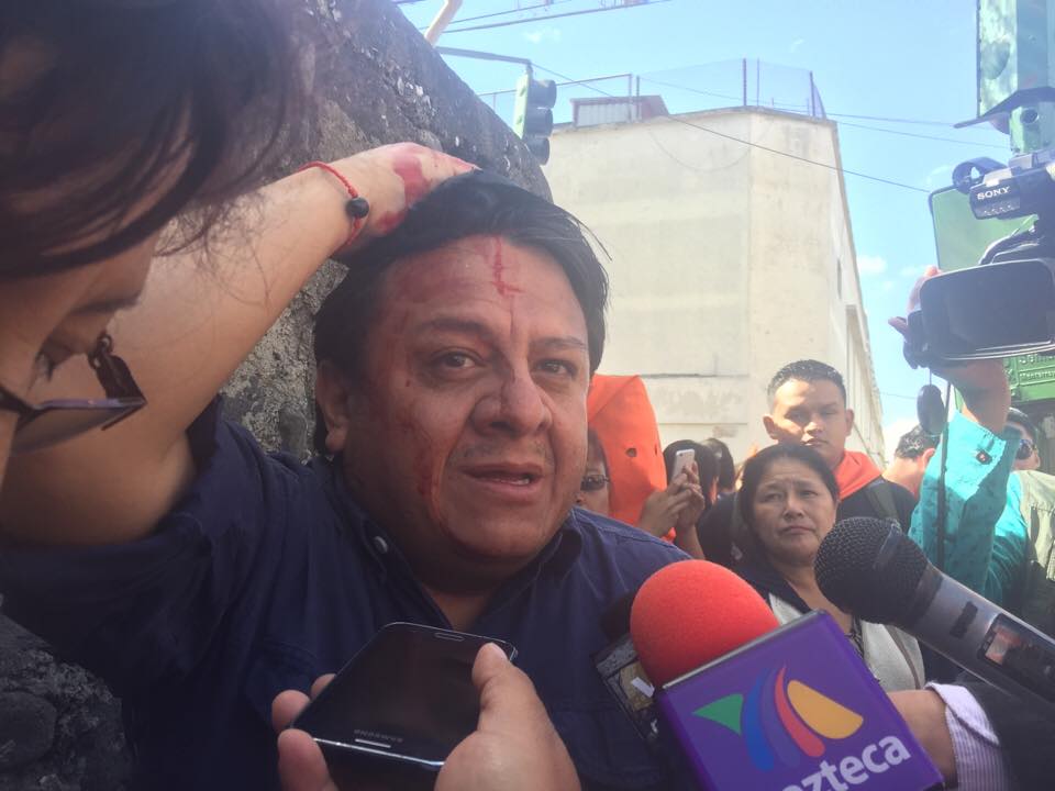 crfger's tweet photo. Defensor de Derechos Humanos @jorgesantos15 es agredido por encapuchados a las afuera del paraninfo universitario. https://t.co/g5nBje9umr
