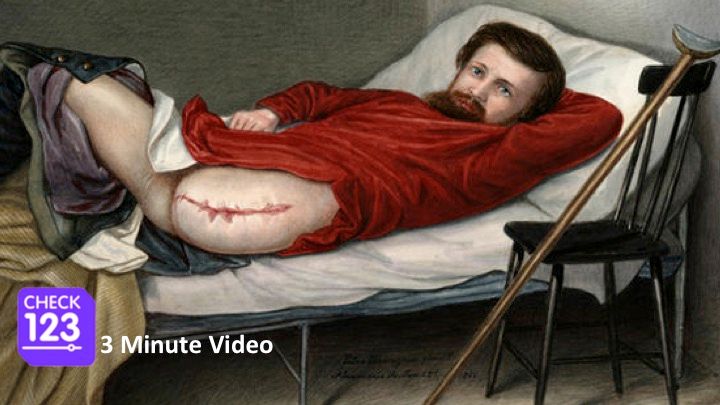 Check123H's tweet image. The gruesome reality of Civil War medicine!
Video: check123.com/videos/9449-am…
#history