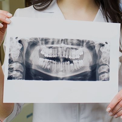 Twin Peaks Dental (@TwinPeaksOCCA) / Posts / X