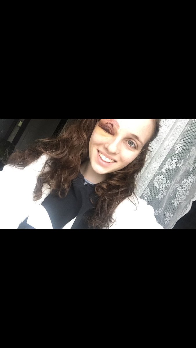 Larascheiddt's tweet photo. Bon j'ai jamais osé mettre ça sur Twitter mais maintenant que c'est derrière moi je choque un peu vos tl #2012vs2018 https://t.co/4pNrYLkOEx