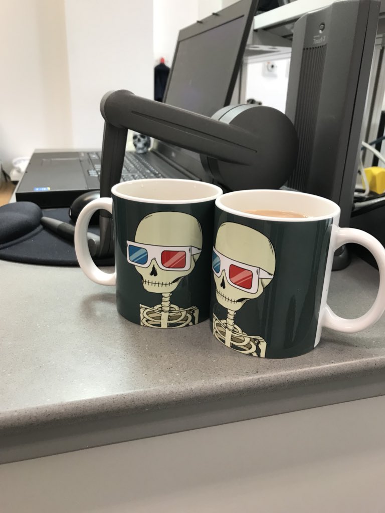 Amy Davey (@amyreconscience) on Twitter photo Look at our awesome new lab mugs! Thanks <a href="/ARMCobb/">Ali Cobb FRCS</a> 👌🏻 #3Dskull #3Dtechnology #craniomaxillofacial #reconstructivescience Look at our awesome new lab mugs! Thanks <a href="/ARMCobb/">Ali Cobb FRCS</a> 👌🏻 #3Dskull #3Dtechnology #craniomaxillofacial #reconstructivescience