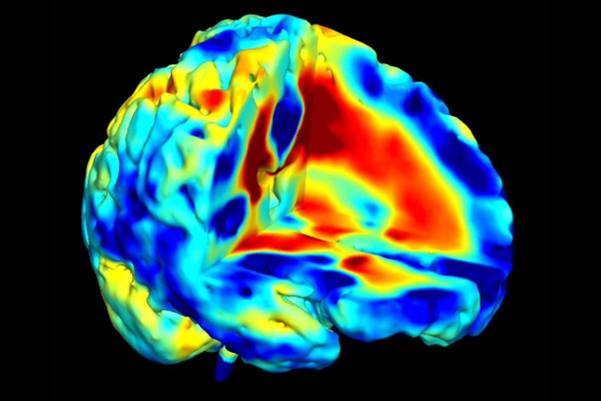 First anatomical evidence of several types of schizophrenia bit.ly/2pvBidJ