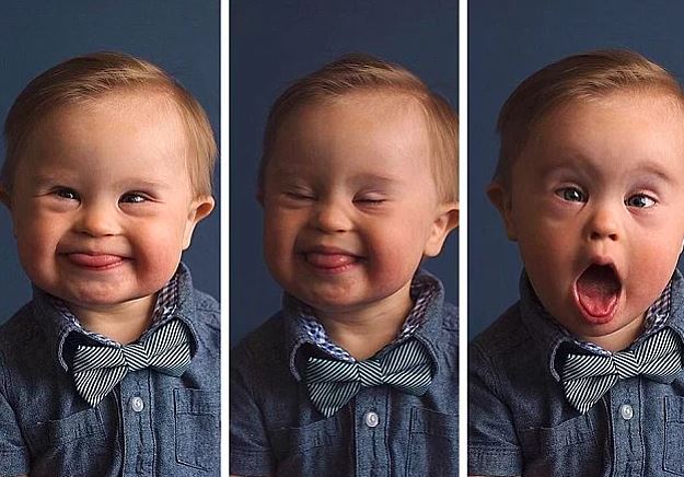 #Downsendromufarkındalıkgünü