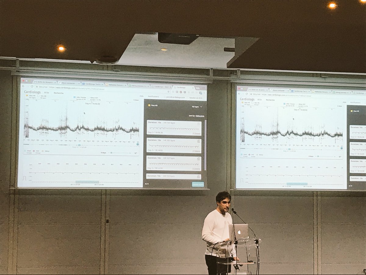 SebastienLe_Roy's tweet image. Live demo of @CardioLogs at #DataDrivenParis @yannfleureau @serenacap #AI
