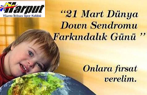 elazigyuzmeihtisas.com 
#21mart #downsendromu