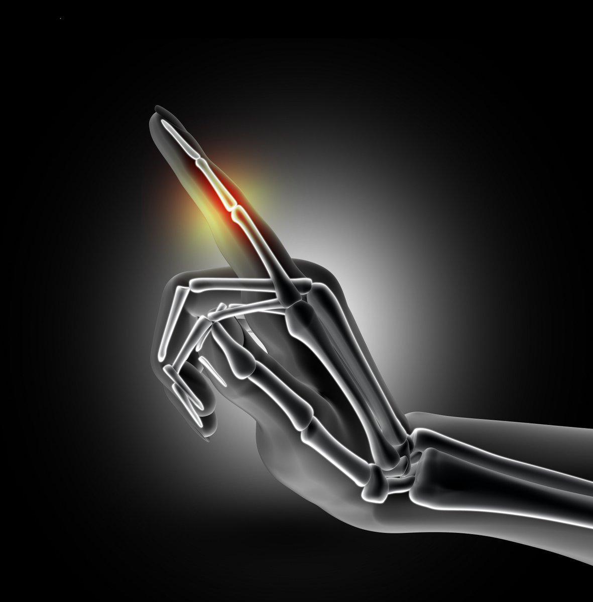_MedAssist's tweet photo. 1 square inch of our hand = 9 feet of blood vessels,600 pain sensors,9000 nerve endings,36 heat sensors &amp;75 pressure sensors #MedAssistKnows https://t.co/cARwoEg0sC