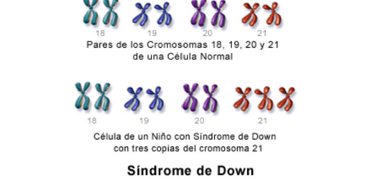 Un cromosoma más, sólo debe provocarnos más amor. #DiaMundialDelSindromeDeDown #21deMarzo
