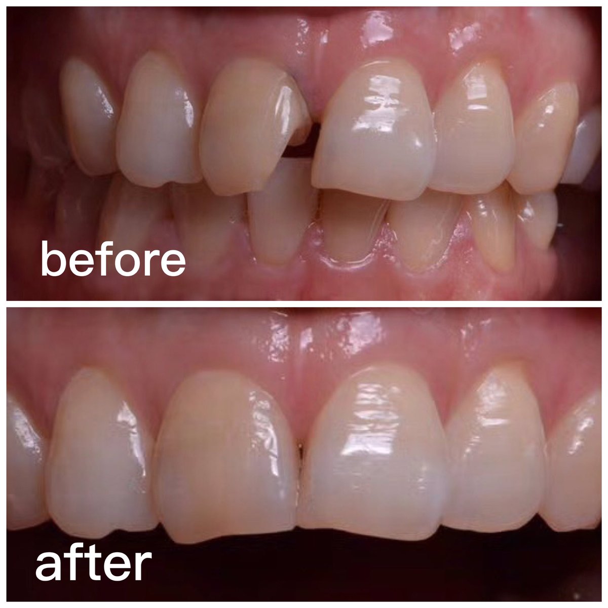 TOP Dental Lab (TOP_dentallab) Twitter