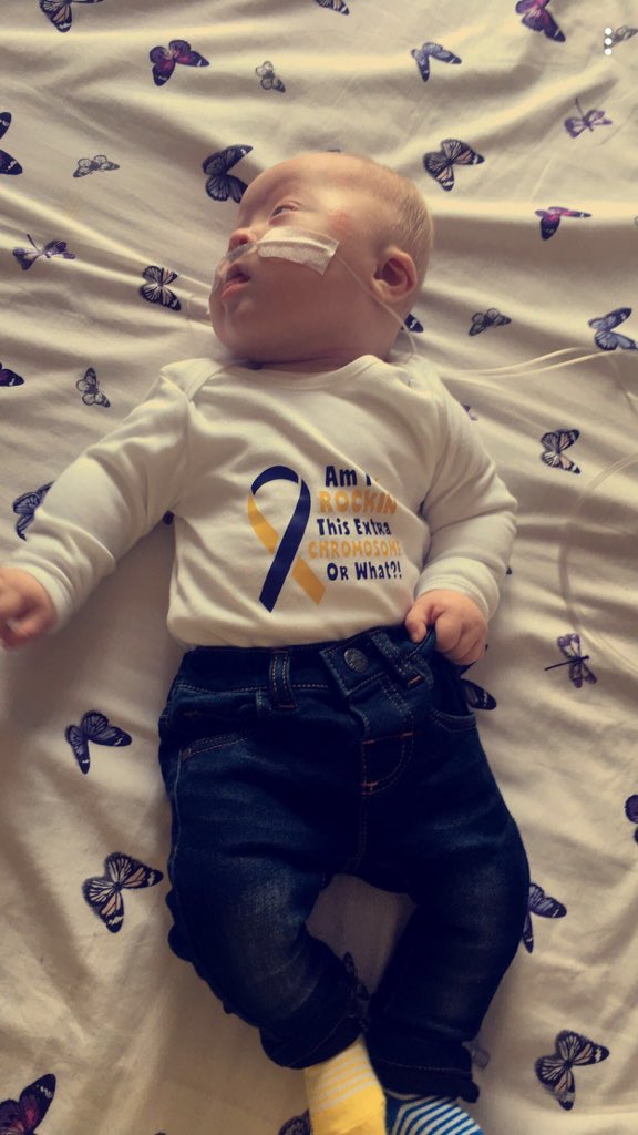 clarebirchie6's tweet photo. Her certainly do rock that extra chromosome #WSWD18 #wouldntchangeathing https://t.co/B4MDH7vZRS