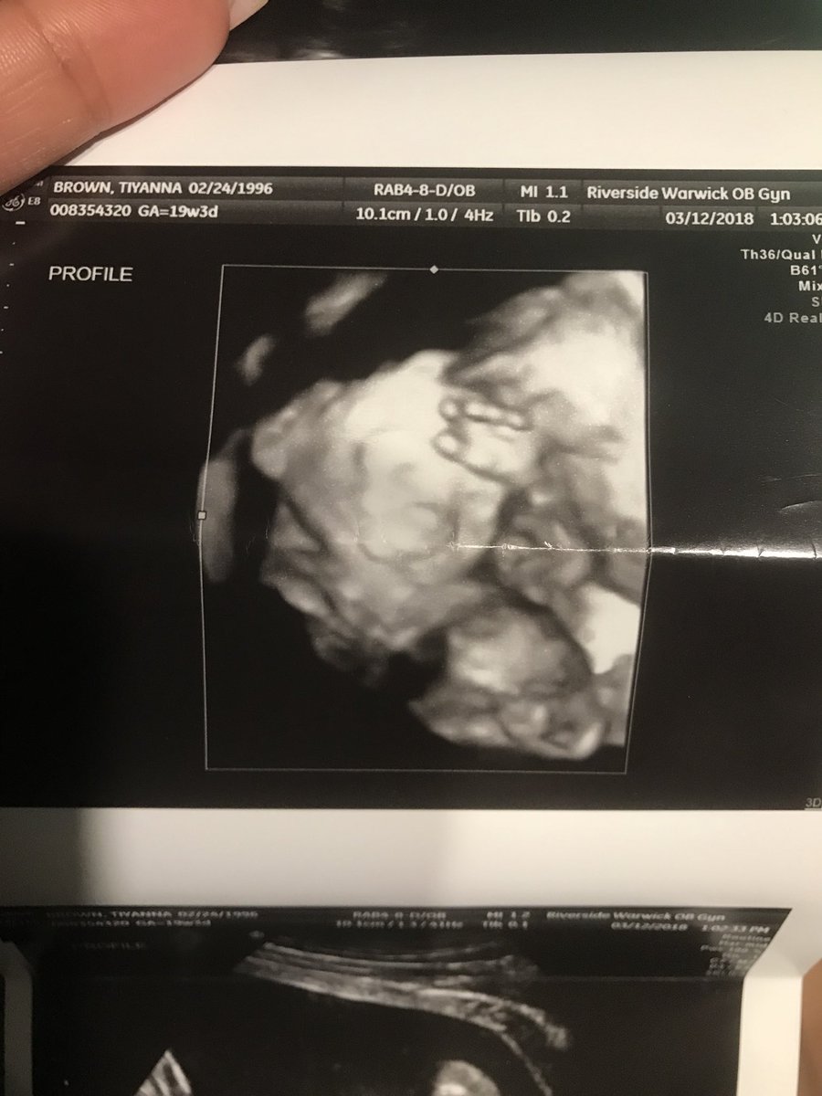 __Yaannaa__'s tweet photo. Baby boy , mommy loves you so much 💙 can’t wait for your arrival #20moreweeks https://t.co/DsK0CHLoNK