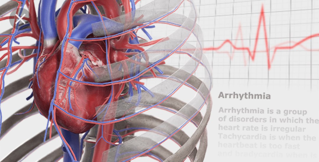 Lars Peder Bovim tweet media