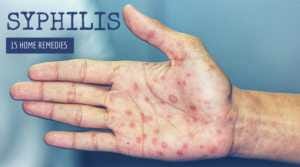 15 Natural Home Remedies for Syphilis - tinyurl.com/yckdgusw
#syphilis #SyphilisTreatment