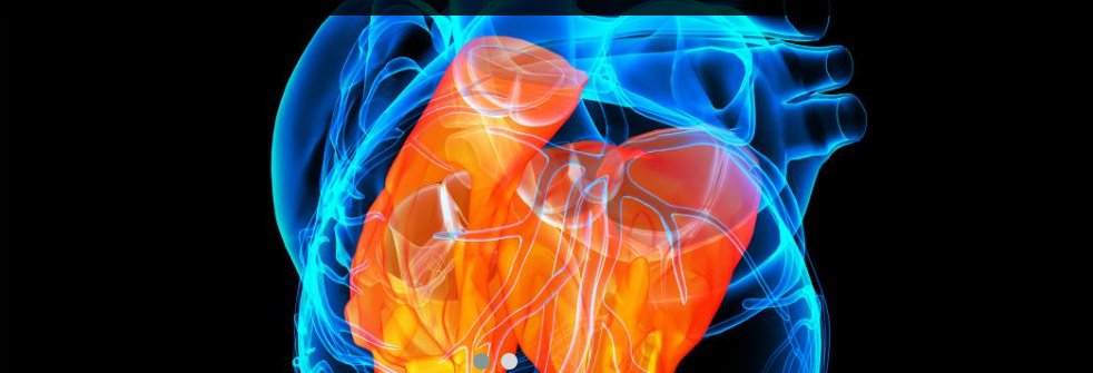 touchCARDIO's tweet photo. #IntermittentLeftBundleBranchBlock – A Challenging Case of Rare #Electrocardiogram Phenomenon https://t.co/lTp1WLaifu #AspergillusBacteremia #AspergillusEndocarditis #AorticValveEndocarditis #ConductionAbnormality #Endocarditits https://t.co/wKyHC6VoGe