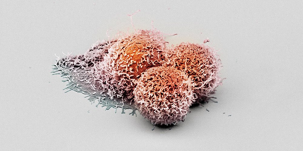 Teknosciences's tweet photo. Des chercheurs ont découvert une protéine appelée LHPP capable de ralentir le développement du cancer du foie
https://t.co/Vkljurzg9L https://t.co/HUvLdoJkDr