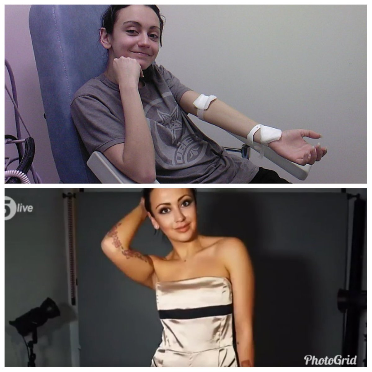 realmissbalmain's tweet image. #FromThis #ToThis - It's always good to remember just how far you've come. Top pic is me on day of my #T1D #diagnosis, 7 Jan '07. I weighed about 6 st/40kg at 5'7" height. Bottom is me now. Sometimes gaining weight is better! #TransformationTuesday #iknowitsnotTuesday