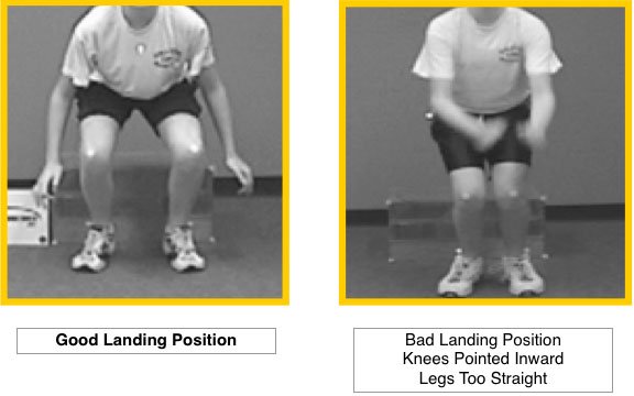 Sportsmd's tweet photo. Female and male athletes can lower their risk of torn ACL by participating in performance drills that focus on improving lower extremity strength, agility, flexibility and form. https://t.co/IemEGmm8Lh https://t.co/WaA8fzmaOt