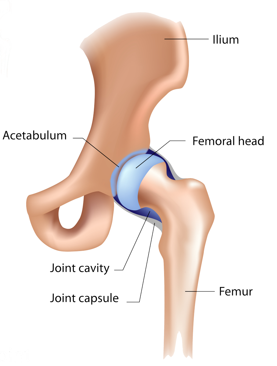 A sports injury or other traumatic event may cause small fragments of #articularcartilage to break off in the #hip joint, known as loose bodies medilink.us/q2hd
