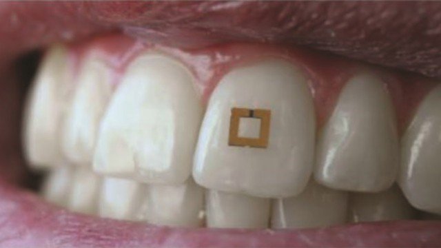 Towards tracking #diet in real-time - this tooth-mounted sensor knows what you've eaten alphr.com/health/1008879… via <a href="/alphr/">Alphr</a> #dentistry #wearables #foodTech