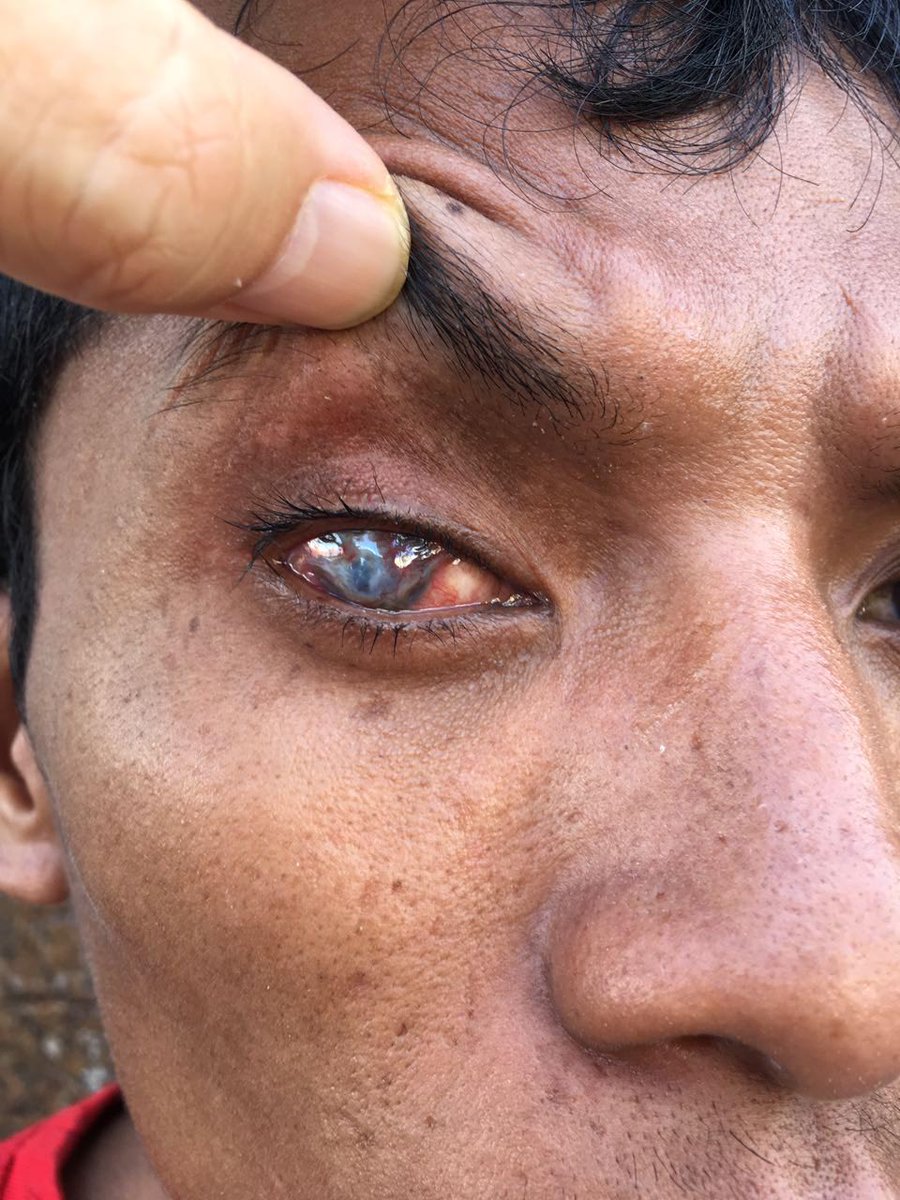 10,000+ Cambodians suffer from avoidable blindness each year. That's 90% of the blind population being able to be treated. It's #iAware's mission to help before it becomes too late for anyone 🙏 Learn more at iaware.tv/beneficiaryon