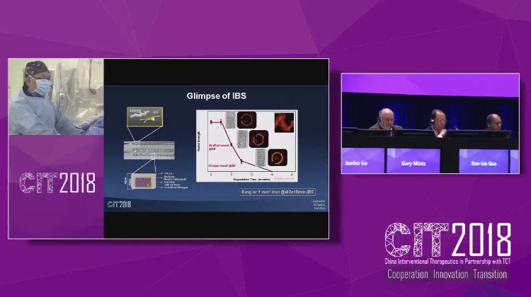 LifeTechScient's tweet photo. The first worldwide transmission of very successful first-in-man implantation of iron-based bioabsorbable coronary scaffold (IBS) #livecase #CIT2018 #innovation https://t.co/XNyRDbZNlV