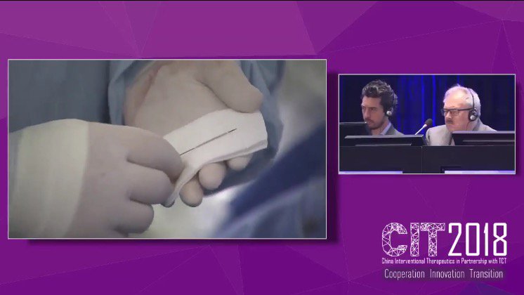 LifeTechScient's tweet photo. The first worldwide transmission of very successful first-in-man implantation of iron-based bioabsorbable coronary scaffold (IBS) #livecase #CIT2018 #innovation https://t.co/XNyRDbZNlV