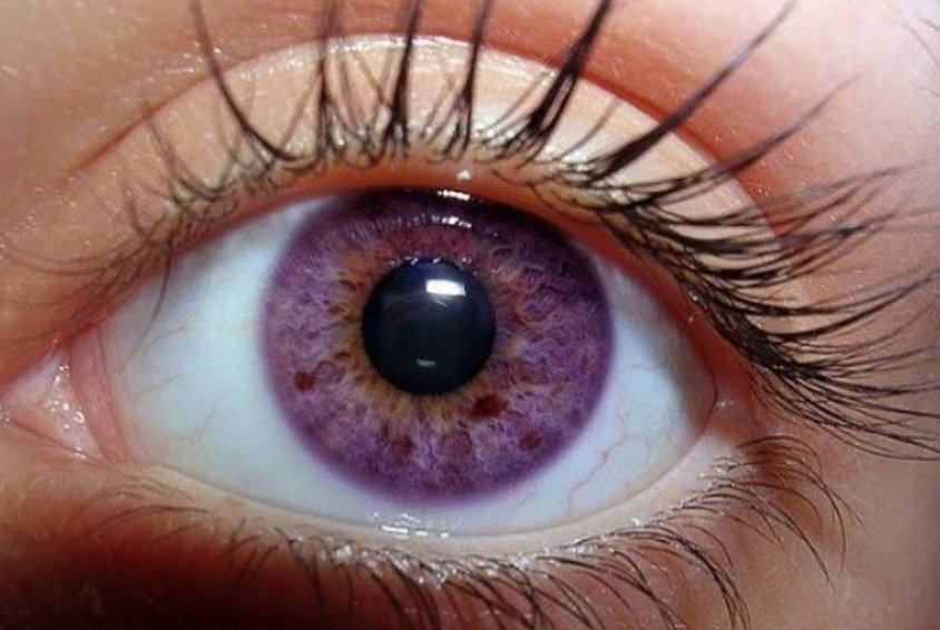 Matteo On Twitter Il Colore Degli Occhi Più Raro è Il