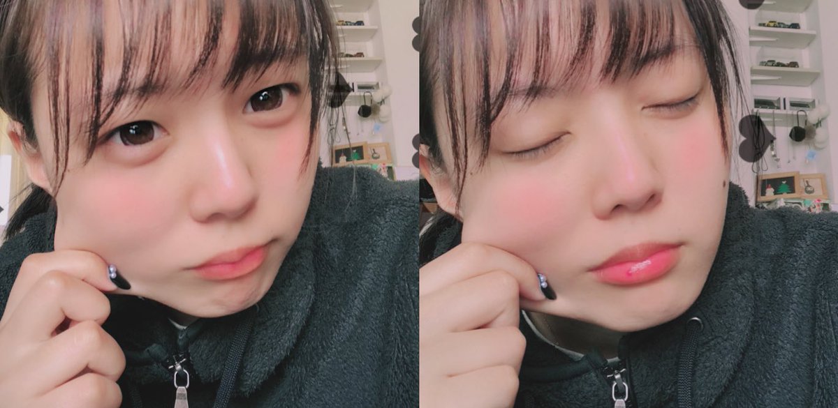 藤山千亜希 Andcrazy Break Pa Twitter 元々唇にあるのよね 赤い斑点 口紅で隠れるけどすっぴんだと隠れないね ヘルペスとかじゃないか大丈夫よありがとう 藤山千亜希 Andcrazy Break Pa Twitter 元々唇にあるのよね 赤い斑点 口紅で隠れるけどすっぴんだと隠れないね ヘルペスとかじゃないか大丈夫よありがとう