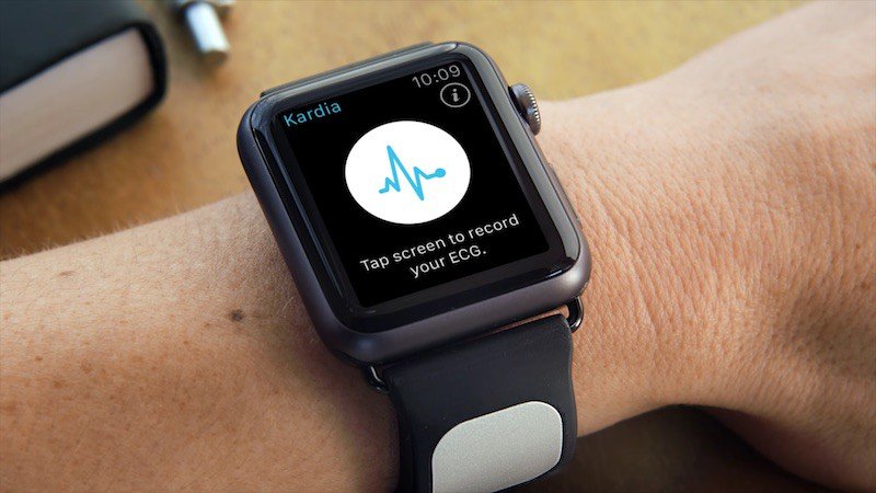 MacRumors's tweet image. Study Suggests AliveCor KardiaBand for Apple Watch Can Be Used With AI Algorithm to Detect High Potassium macrumors.com/2018/03/11/ali… by @julipuli