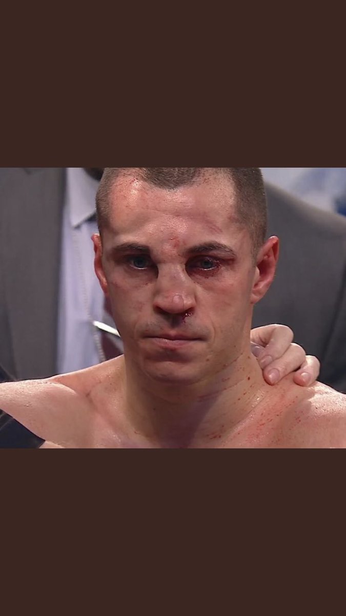 daz1010's tweet photo. That was the sound of a tool chest falling down the stairs 😂😂😂 #quigg #flatnose https://t.co/coOEFe8PnX