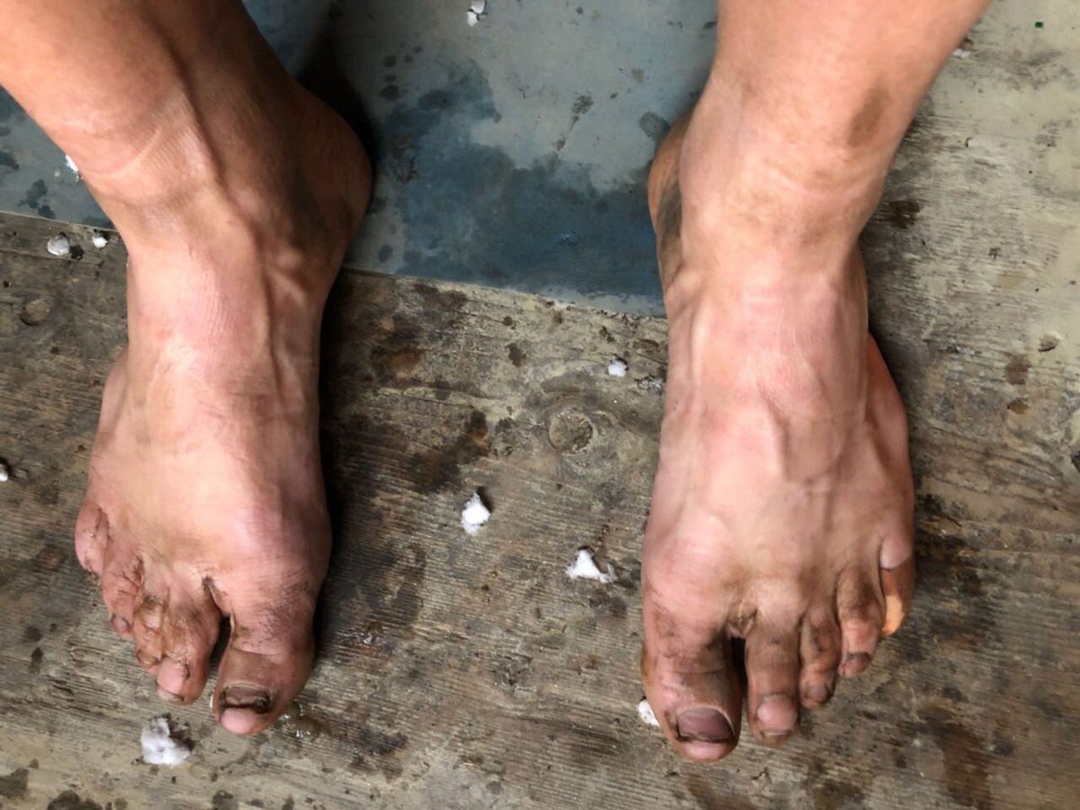 ryansandes's tweet photo. Anyone want to give me a pedicure? 🤣
#GHT2018 #timetoplay #himalayas https://t.co/tPfF5zPEmq