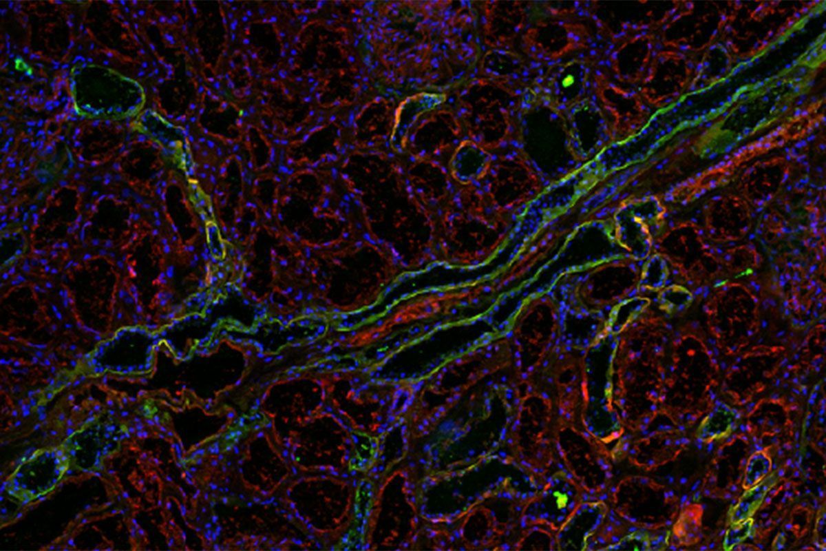 #WashUMed researchers have found a way to treat urinary tract infections in mice without antibiotics, a step toward averting the growing problem of #AntibioticResistance bit.ly/2FCGINT