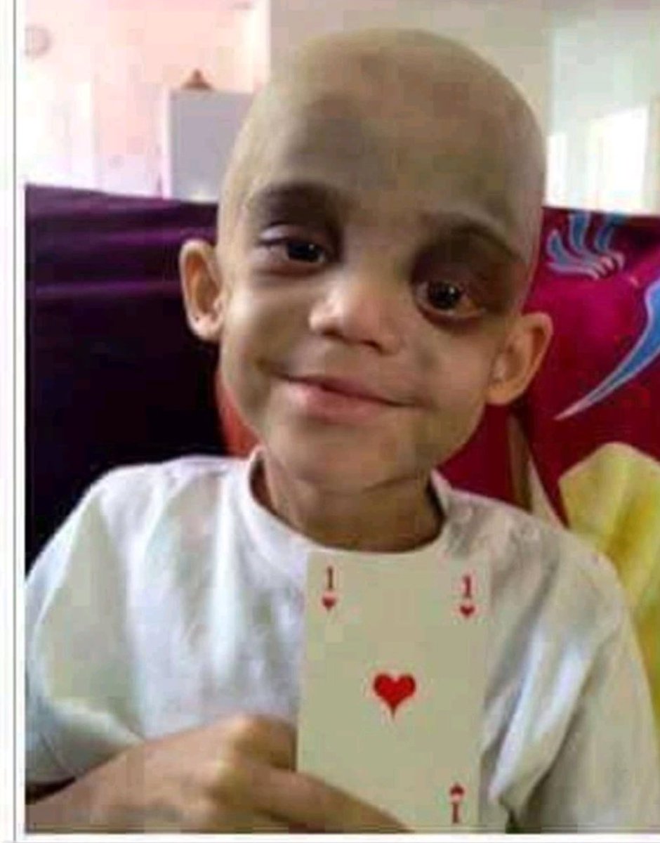 Kwdeelo's tweet photo. جرعه الكيماوي التي تعطئ في الوريد لمرضئ السرطان لو سقطت قطره علي جلد الانسان لأذابته ، فعن اي ألمٍ او وجعٍ تتحدثون ؟ 
اللهم أرحمهم برحمتك وخفف عنهم آللآمهم 🙌🏻 https://t.co/BVBI90XtAJ