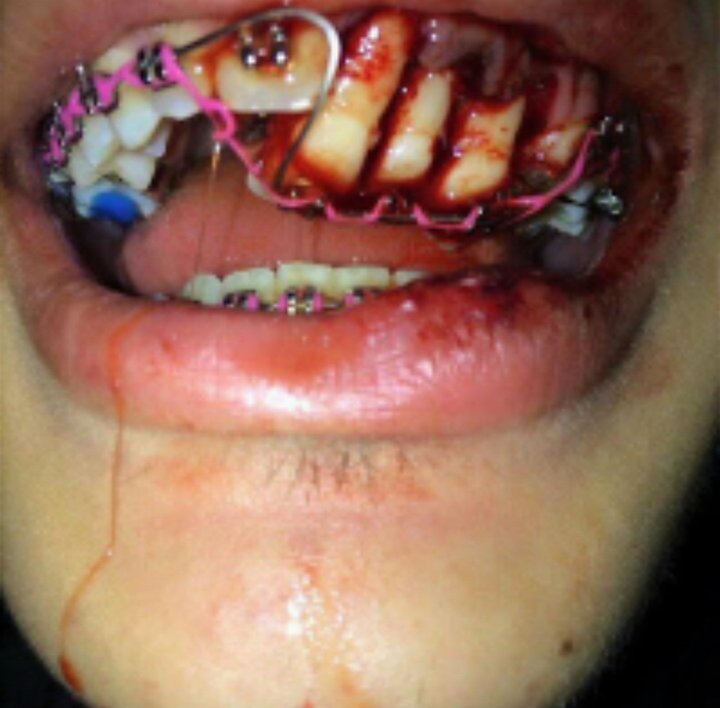 rawleak_'s tweet photo. [NSFW] How do you deal with this? https://t.co/SkPpA8jj5h