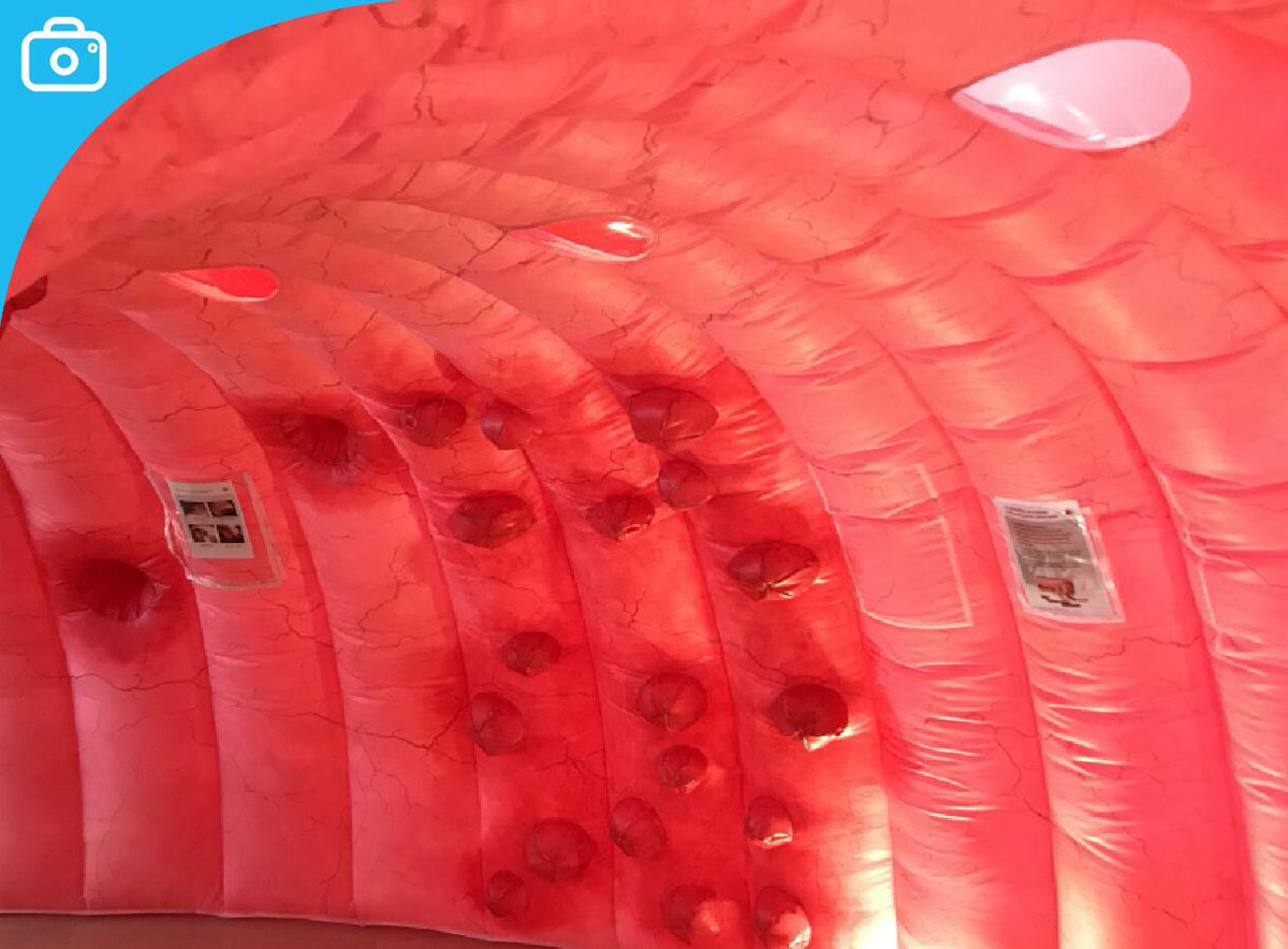 HParisStJoseph's tweet photo. #MarsBleu Que se passe-t-il dans le #côlon lorsque les #polypes se développent ? La journée de mobilisation contre le #cancer #colorectal @GHPSJ vous permet de visiter l’intérieur du côlon pour mieux comprendre. https://t.co/MlmWbK6t4X