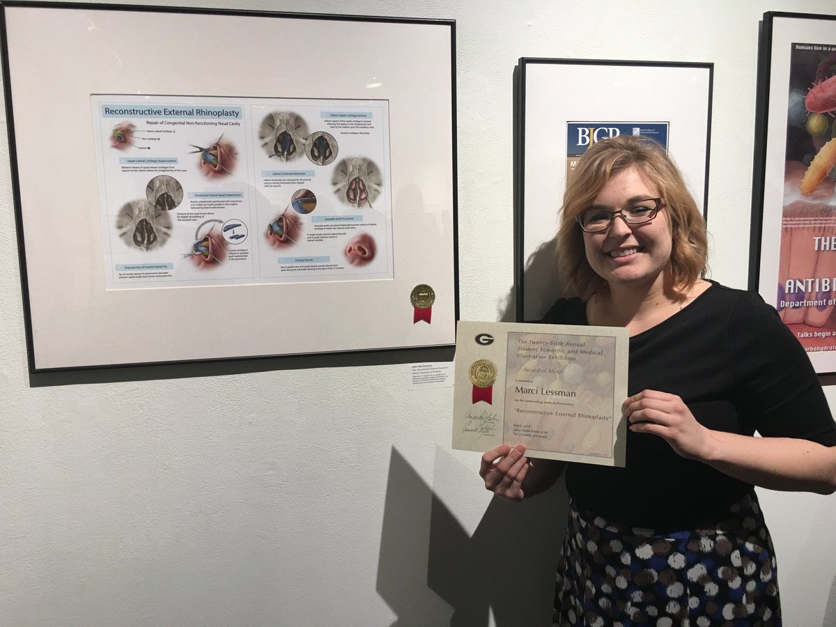 Congratulations, Marci Lessman (CO 2018) on receiving an Award of Merit for her surgical illustration “Reconstructive External Rhinoplasty” at the 26th Annual UGA/AU Scientific and Medical Illustration Exhibit.  #medart <a href="/AUG_University/">Augusta University</a>