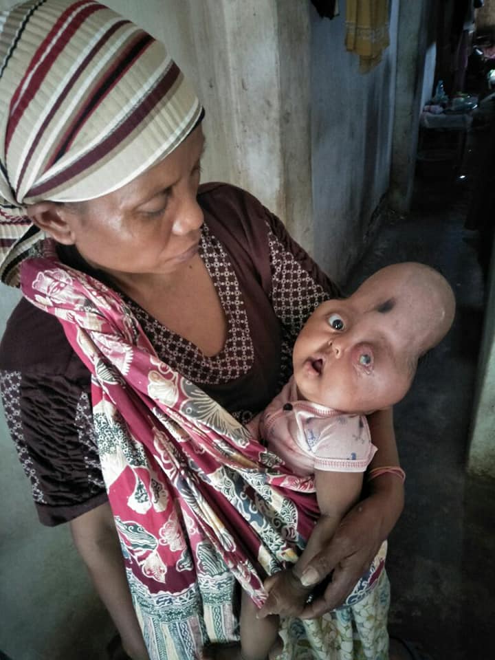 Sungguh Malang Balita Probolinggo ini menderita tumor sdgkan  Orang tuanya hidup menumpang di rumah tetangga..  info lokasi sentuh > facebook.com/kraksaan/posts… <a href="/jokowi/">Joko Widodo</a> <a href="/mohmahfudmd/">Mahfud MD</a> <a href="/kaesangp/">“kak” Kaesang</a> <a href="/_TNIAU/">TNI Angkatan Udara</a> <a href="/DivHumas_Polri/">Humas Polri</a>