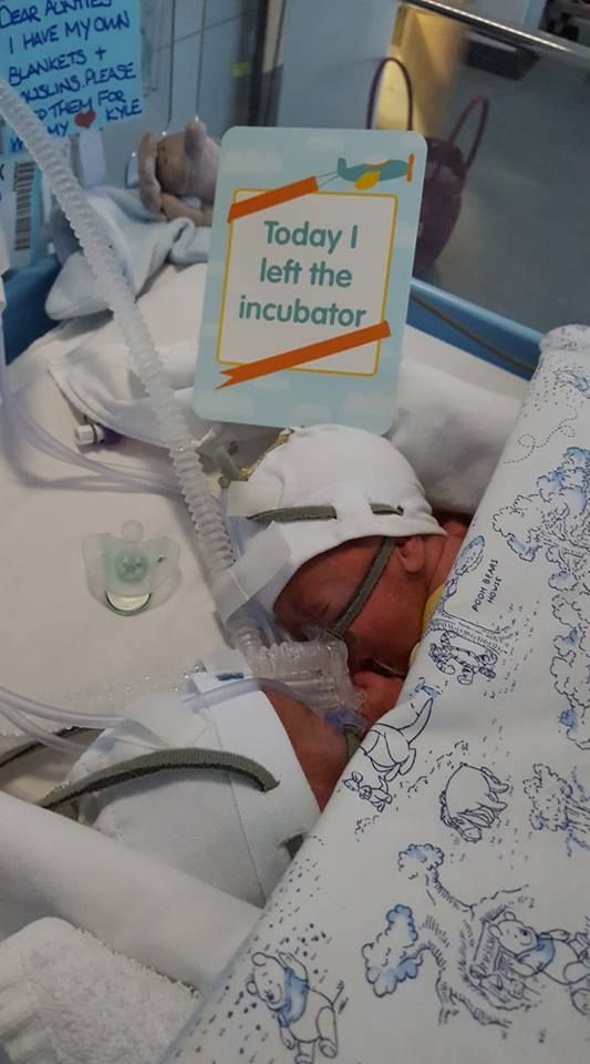 This week’s #MilestoneMondays feature goes to Christine! She sent us this lovely photo of her twin boys, born at 26 weeks, leaving their incubators to share a double cot. 

Tag us in your photo <a href="/blisscharity/">Bliss Baby Charity</a> with #MilestoneMondays for a chance to be featured next Monday!